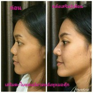 เมนูของร้าน Dmor Clinic รัชดาภิเษก