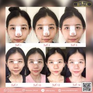 Blink Clinic by Dr.Mai สุขุมวิท 23