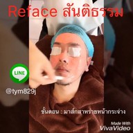 นวดหน้ารีเฟซ สันติธรรม