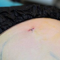 The SIB Clinic สยามสแควร์วัน