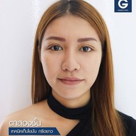 Genesis clinic (เจนิซิส คลินิก)