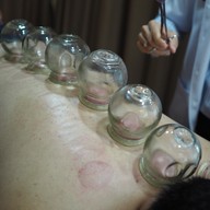 หลินจือ คลินิคฝังเข็ม