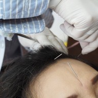 หลินจือ คลินิคฝังเข็ม