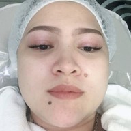 SLC Siam Laser Clinic เซ็นทรัลพลาซา บางนา