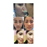 SLC Siam Laser Clinic เซ็นทรัลพลาซา บางนา