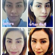SLC Siam Laser Clinic เซ็นทรัลพลาซา ลาดพร้าว