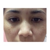 SLC Siam Laser Clinic เซ็นทรัลพลาซา บางนา