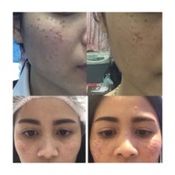 SLC Siam Laser Clinic เซ็นทรัลพลาซา บางนา