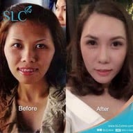 SLC Siam Laser Clinic เซ็นทรัลพลาซา ลาดพร้าว