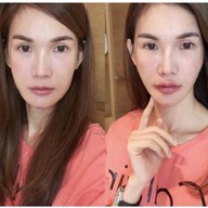 SLC Siam Laser Clinic เซ็นทรัลพลาซา ลาดพร้าว