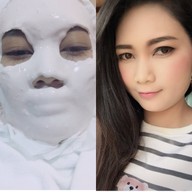 SLC Siam Laser Clinic เซ็นทรัลพลาซา ลาดพร้าว