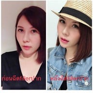 SLC Siam Laser Clinic เซ็นทรัลพลาซา ลาดพร้าว