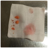 SLC Siam Laser Clinic เซ็นทรัลพลาซา พระรามเก้า