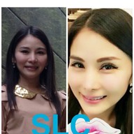 SLC Siam Laser Clinic เซ็นทรัลพลาซา ลาดพร้าว
