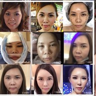 SLC Siam Laser Clinic เซ็นทรัลพลาซา ลาดพร้าว