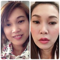 SLC Siam Laser Clinic เซ็นทรัลพลาซา ลาดพร้าว