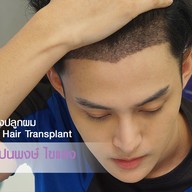 Apex Profound Beauty ทองหล่อ