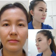 แพรีส คลินิก The Capital​ Clinic​