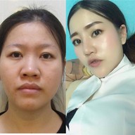 แพรีส คลินิก The Capital​ Clinic​