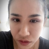 กรวินคลินิก งามวงศ์วาน