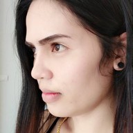 กรวินคลินิก งามวงศ์วาน