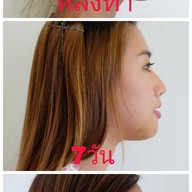 เมนูของร้าน YKJ Medical Center by ธีระธรฌ์คลินิก