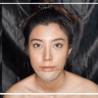 Ametise Clinic Sathon Soi 1