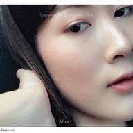 Cosmacare Clinic เลียบทางด่วนรามอินทรา(นวลจันทร์) , ทองหล่อ ซอย 5 , สยามซอย 9 , โลตัส - ศรีนครินทร์ , คริสตัลพาร์ค - เลียบทางด่วนรามอินทรา , โลตัส - วังหิน