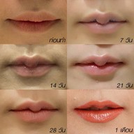 Meko Clinic เซ็นทรัลเวิลด์