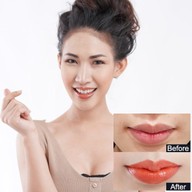 Meko Clinic เซ็นทรัลเวิลด์