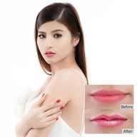 Meko Clinic เซ็นทรัลเวิลด์