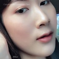 Cosmacare Clinic เลียบทางด่วนรามอินทรา(นวลจันทร์) , ทองหล่อ ซอย 5 , สยามซอย 9 , โลตัส - ศรีนครินทร์ , คริสตัลพาร์ค - เลียบทางด่วนรามอินทรา , โลตัส - วังหิน