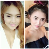 VVER CLINIC ปิ่นเกล้า