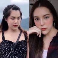 VVER CLINIC ปิ่นเกล้า