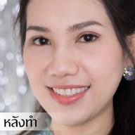 Ametise Clinic Sathon Soi 1