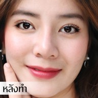 Ametise Clinic Sathon Soi 1