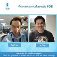 The Skin Clinic เซ็นทรัลพระราม 2