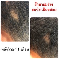 เมนูของร้าน LC Clinic โคราช นครราชสีมา