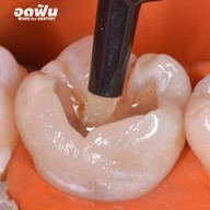 เมนูของร้าน ศาลาแดง ซ.1 ทันตกรรม (SDC1st Dentist)