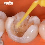 เมนูของร้าน ศาลาแดง ซ.1 ทันตกรรม (SDC1st Dentist)