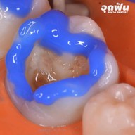 เมนูของร้าน ศาลาแดง ซ.1 ทันตกรรม (SDC1st Dentist)