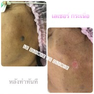 เมนูของร้าน LC Clinic โคราช นครราชสีมา