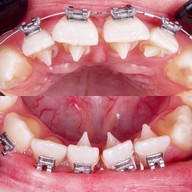 ศาลาแดง ซ.1 ทันตกรรม (SDC1st Dentist)