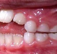 ศาลาแดง ซ.1 ทันตกรรม (SDC1st Dentist)