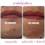 เมนูของร้าน LC Clinic (แอลซีคลินิก) ประโคนชัย จ.บุรีรัมย์