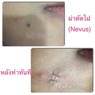 LC Clinic โคราช นครราชสีมา