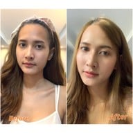 The Scarlett Clinic สยามพารากอน