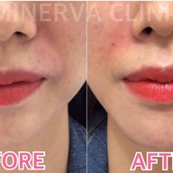 Minerva Clinic สยามพารากอน