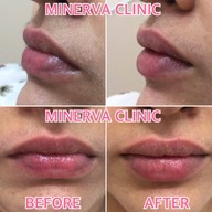Minerva Clinic สยามพารากอน