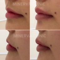 Minerva Clinic สยามพารากอน